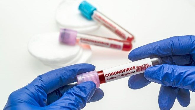 24 Mart 2021 koronavirüs vaka tablosu! Vaka sayısı 30 bine yaklaştı